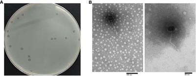 A lytic phage to control multidrug-resistant avian pathogenic Escherichia coli (APEC) infection